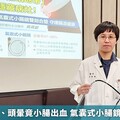 阿嬤解黑便、頭暈竟小腸出血 氣囊式小腸鏡精準揪病灶