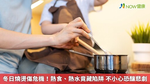 冬日燒燙傷危機！熱食、熱水竟藏陷阱 不小心恐釀悲劇