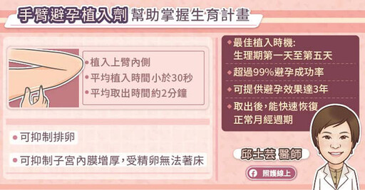 不吃藥、不戴套！手臂避孕植入劑 3年避孕效果逾99%