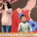 罕病結節硬化症病徵多樣難診斷 白斑合併癲癇及早就醫