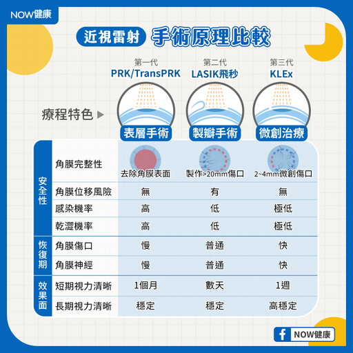 常見近視雷射手術比一比 眼科醫師分析特色及適合族群