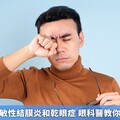 春天常見過敏性結膜炎和乾眼症 眼科醫教你區分與治療