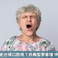 無菸酒檳榔史也得口腔癌？非典型患者增 中醫辯證論治