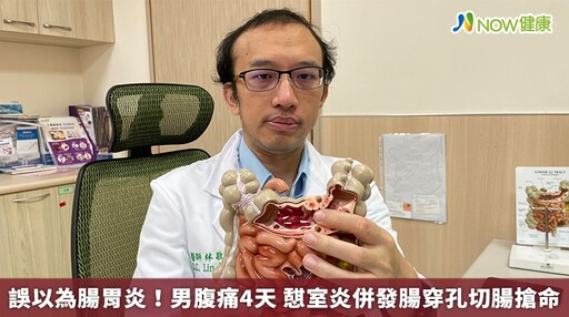 誤以為腸胃炎！男腹痛4天 憇室炎併發腸穿孔切腸搶命