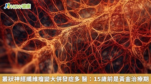 叢狀神經纖維瘤變大併發症多 醫：15歲前是黃金治療期