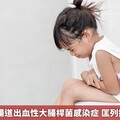 近3年首例腸道出血性大腸桿菌感染症 匡列接觸者34人