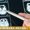 研究：長期飲酒有腦損風險 戒斷初期當心「譫妄」反撲