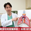 老菸槍愛唱歌突狂咳竟罹肺癌！ 出現3狀況恐事態不妙
