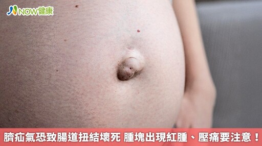 臍疝氣恐致腸道扭結壞死 腫塊出現紅腫、壓痛要注意!