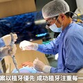 缺牙解決方案以植牙優先 成功植牙注重每一個植牙環節