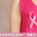 乳房X光攝影助揪早期乳癌徵兆！ 醫釐清2大常見迷思