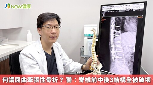 何謂屈曲牽張性骨折? 醫:脊椎前中後3結構全被破壞