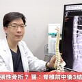 何謂屈曲牽張性骨折？ 醫：脊椎前中後3結構全被破壞