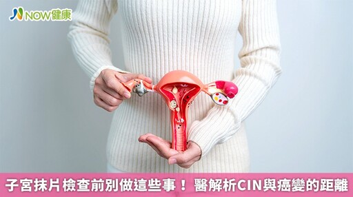 子宮抹片檢查前別做這些事! 醫解析CIN與癌變的距離