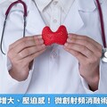 甲狀腺結節增大、壓迫感！ 微創射頻消融術免開刀改善