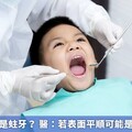 牙齒黑黑就是蛀牙？ 醫：若表面平順可能是硫化鐵沉積