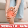 網友熱議5大足部職業病大公開！ 足底筋膜炎只排第3位