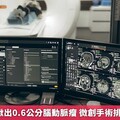 7旬婦健檢揪出0.6公分腦動脈瘤 微創手術排除中風危機