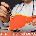 脂肪肝也會傷「心」！ 研究：罹患心肌梗塞機率達46%