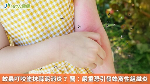 蚊蟲叮咬塗抹蒜泥消炎? 醫:嚴重恐引發蜂窩性組織炎