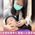 美顏針不動刀改善肌膚老化 愛美人士追求自然美新選擇