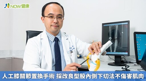 人工膝關節置換手術 採改良型股內側下切法不傷害肌肉
