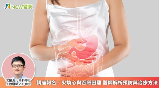 講座報名/火燒心與吞嚥困難 醫師解析預防與治療方法
