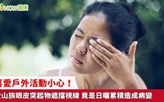 喜愛戶外活動小心！登山族眼皮突起物遮擋視線 竟是日曬累積造成病變