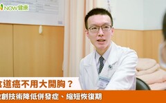 食道癌不用大開胸？ 微創技術降低併發症、縮短恢復期