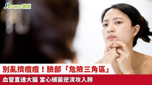別亂擠痘痘！臉部「危險三角區」血管直通大腦 當心細菌逆流攻入肺