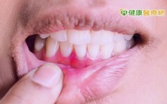 刷牙力道越大，牙齒越乾淨？ 「出現這些狀況」恐是牙齦退縮