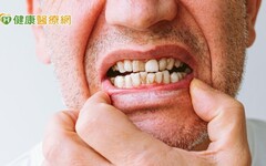 他嚴重牙周病戴活動假牙食物咬不爛 「1招」解噴假牙、咀嚼卡卡困擾