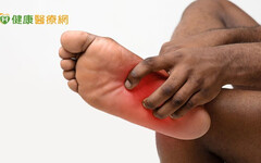 香港腳不理它，感染蜂窩性組織炎 「紅腫熱痛」險截肢保命
