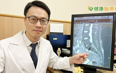 長期下背痛是椎間盤突出惹禍 脊椎內視鏡治療效果佳