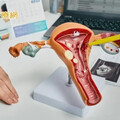 無法懷孕又經期異常 「子宮鏡冷刀手術」重建子宮生機