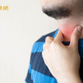 30歲男聲音沙啞竟是聲帶長繭！ 醫揭「治療方式」恢復嗓音