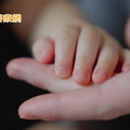 腸病毒「伊科病毒」已致嬰兒2死1重症！ 醫師示警提高警覺不排除大流行
