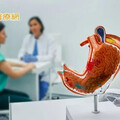 八旬翁罹胃癌憂手術風險 「1治療方式」免挨刀切胃