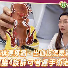 痔瘡導致排便疼痛、出血該怎麼辦？ 醫師建議4族群可考慮手術治療！
