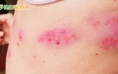 年長者免疫力逐年下滑 醫籲：定期接種「這些疫苗」建立防護力