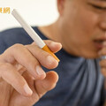 65歲男久咳未痊以為感冒 一檢竟是「肺癌」上身