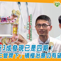 大腸癌近3成發現已是四期！醫：「三管齊下」積極治療仍有望延長存活