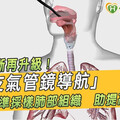 肺癌診斷再升級！「AI支氣管鏡導航」精準採樣肺部組織 助提高診斷率