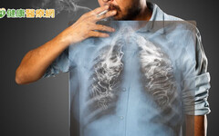 肺阻塞傷肺也傷心！教你「5大抗惡行動」保肺護心、防惡化