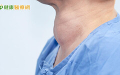 失控的甲狀腺亢進可能引發甲狀腺風暴！醫師教你如何控制甲狀腺