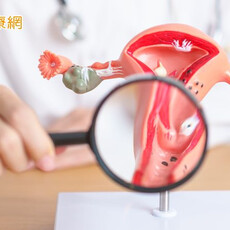 台灣迎戰「世界消除子宮頸癌日」 篩檢下修至25歲＋3措施升級防護