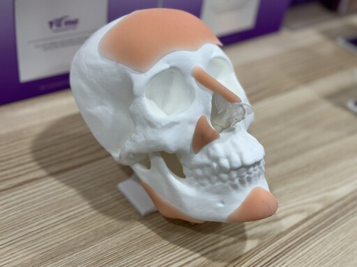 3D列印技術讓「隆鼻」更自然！醫曝關鍵好處：有望大幅降低手術失敗風險