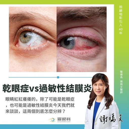 乾眼症VS過敏性結膜炎 1看「眼淚多少」就知道！醫授識別關鍵、治療方法一次搞懂