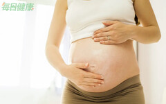 懷孕恐妊娠紋上身！醫授4撇步「肚皮不爆紋」：1動作必做、補充它更有彈性