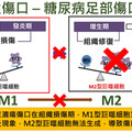 「高血糖障礙」卡在發炎期，糖尿病足潰瘍易截肢！醫：平衡微環境幫助快速癒合